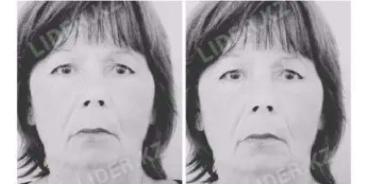 Петропавлда 75 жастағы зейнеткер қайғылы қазаға ұшырады: аурухана маңында үсіп, көз жұмды